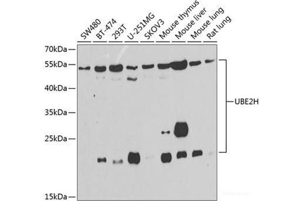 UBE2H antibody