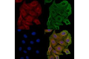 ABIN6257586 and ABIN6274837 staining Hela cells by IF/ICC.
