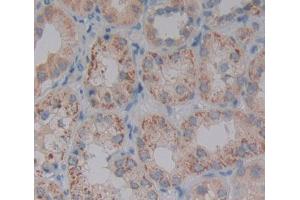 Used in DAB staining on fromalin fixed paraffin- embedded kidney tissue (PDP2 antibody  (AA 1-186))