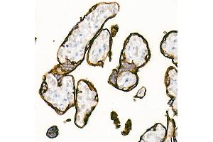 Immunohistochemistry of paraffin-embedded Human placenta using Placental alkaline phosphatase (PLAP) antibody (ABIN1682693, ABIN7101664, ABIN7101665 and ABIN7101666) at dilution of 1:1000 (40x lens). (PLAP antibody)