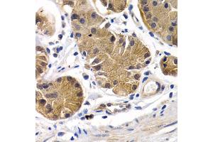 Immunohistochemistry of paraffin-embedded human stomach using PTGIR antibody. (Prostacyclin Receptor antibody)