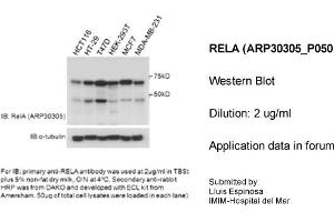 Western Blotting (WB) image for anti-Nuclear Factor-kB p65 (NFkBP65) (Middle Region) antibody (ABIN486792) (NF-kB p65 antibody  (Middle Region))