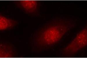 Immunofluorescence (IF) image for anti-Retinoblastoma 1 (RB1) (pSer780) antibody (ABIN1870571) (Retinoblastoma 1 antibody  (pSer780))