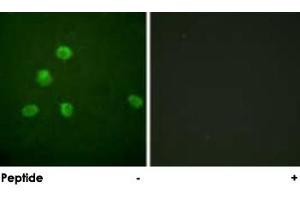 Immunofluorescence analysis of HepG2 cells, using FOSB polyclonal antibody .