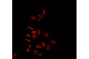 ABIN6266794 staining HepG2 by IF/ICC. (MAP3K3 antibody)