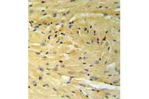 Immunohistochemistry analysis in formalin fixed and paraffin embedded moouse heart tissue reacted with GNAT1 Antibody (C-term) followed which was  peroxidase conjugated to the secondary antibody and followed by AB staining. (GNAT1 antibody  (C-Term))