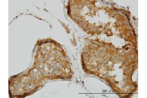 Immunoperoxidase of monoclonal antibody to CSDC2 on formalin-fixed paraffin-embedded human testis. (CSDC2 antibody  (AA 1-153))