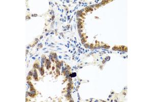 Immunohistochemistry of paraffin-embedded rat lung using C8orf4 antibody (ABIN5975014) at dilution of 1/100 (40x lens). (C8orf4 antibody)