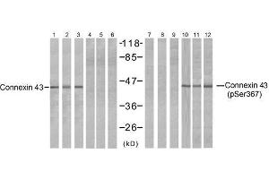 Western blot analysis of extracts from HeLa (Line 1, 4, 7 and 10), K562 (Line 2, 5, 8 and 11) and 293 (Line 3, 6, 9 and 12) cells, untreated or treated with PMA (1ηM 30min), using Connexin43 (Ab-367) antibody (E021250, Lane 1, 2, 3, 4, 5 and 6) and Connexin43 (phospho-Ser367) antibody (E011258, Lane 7, 8, 9, 10, 11 and 12). (Connexin 43/GJA1 antibody)