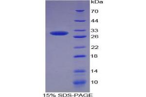 SDS-PAGE analysis of Rat SOD3 Protein.
