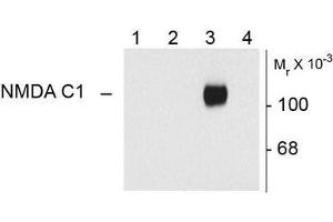 Image no. 1 for anti-NMDA Receptor 1 (NMDA R1) (Splice Variant C1) antibody (ABIN372675)