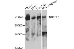 Western blot analysis of extracts of various cell lines, using NOTCH1 antibody. (Notch1 antibody)