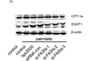 Down-regulation of FASN by siRNA attenuated triglyceride accumulation(A and B) Protein level of FASN in HepG2 cells. (CPT1A antibody  (AA 497-756))