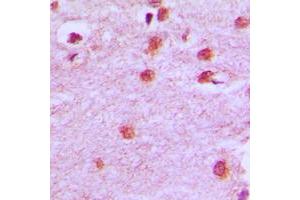 Immunohistochemical analysis of HOXA11/D11 staining in human brain formalin fixed paraffin embedded tissue section. (HOXA11/D11 antibody  (C-Term))