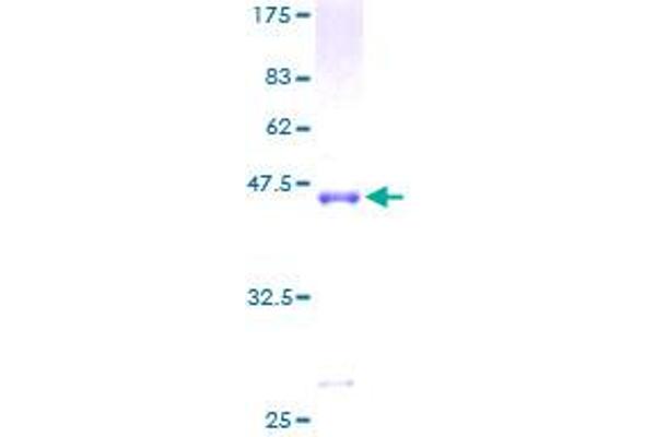 PPP3R1 Protein (AA 1-170) (GST tag)