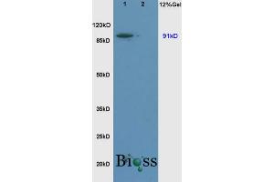 L1 rat brain, L2 rat liver lysates probed (ABIN669426) at 1:200 in 4 °C. (SLC9A1 antibody  (AA 470-550))