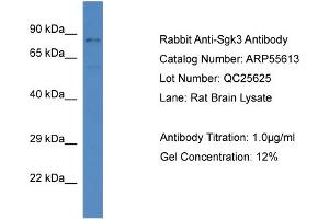 Western Blotting (WB) image for anti-serum/glucocorticoid Regulated Kinase Family, Member 3 (SGK3) (C-Term) antibody (ABIN785759) (SGK3 antibody  (C-Term))