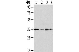 Western Blot analysis of Jurkat, A549, HepG2 and 293T cells using HOXD13 Polyclonal Antibody at dilution of 1/200 (Homeobox D13 antibody)
