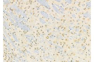 ABIN6258821 and ABIN6274163 at 1/100 staining Mouse brain tissue by IHC-P. (HKR1 antibody  (Internal Region))
