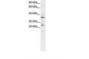 Image no. 1 for anti-Sirtuin 5 (SIRT5) (C-Term) antibody (ABIN6735783) (SIRT5 antibody  (C-Term))