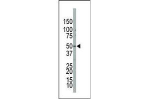 The anti-PIP5K2B Pab (ABIN392600 and ABIN2842128) is used in Western blot to detect PIP5K2B in NCI- cell lysate. (PIP4K2B antibody  (C-Term))