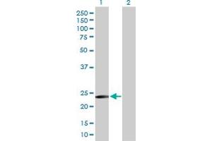 Western Blot analysis of TXNDC9 expression in transfected 293T cell line by TXNDC9 MaxPab polyclonal antibody. (TXNDC9 antibody  (AA 1-188))
