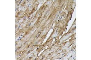 Immunohistochemistry (IHC) image for anti-Suppressor of Cytokine Signaling 3 (SOCS3) (C-Term) antibody (ABIN3021100)