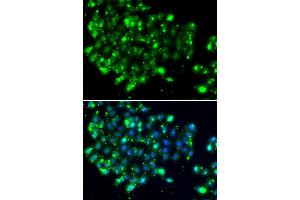 Immunofluorescence analysis of MCF7 cell using NAT9 antibody. (NAT9 antibody)