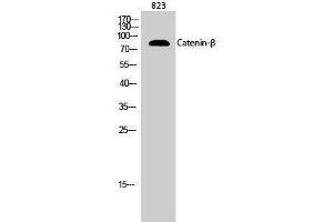 Western Blotting (WB) image for anti-Catenin, beta (CATNB) (Ser289) antibody (ABIN3183683) (beta Catenin antibody  (Ser289))