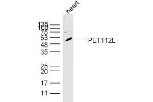 Mouse heart lysates probed with PET112L Polyclonal Antibody, unconjugated  at 1:300 overnight at 4°C followed by a conjugated secondary antibody at 1:10000 for 60 minutes at 37°C. (PET112L antibody  (AA 101-200))