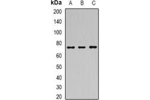 Western blot analysis of SAMHD1 expression in Hela (A), MCF7 (B), mouse spleen (C) whole cell lysates.