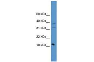 Image no. 1 for anti-Presenilin Enhancer 2 Homolog (PSENEN) (C-Term) antibody (ABIN6746582) (PEN2 antibody  (C-Term))