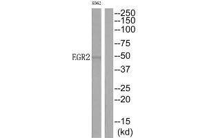 Western Blotting (WB) image for anti-Early Growth Response 2 (EGR2) (C-Term) antibody (ABIN1849151) (EGR2 antibody  (C-Term))