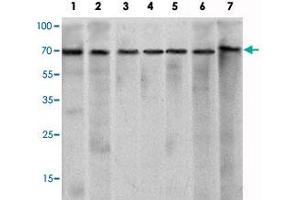 Western blot analysis using CHD3 monoclonal antibody, clone 2G4  against HeLa (1), K-562 (2), Jurkat (3), NTERA-2 (4), HEK293 (5), Raji (6) cell lysate and mouse brain (7) tissue lysate. (CHD3 antibody)