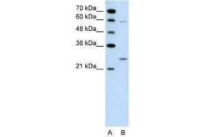 WB Suggested Anti-GAMT  Antibody Titration: 0. (GAMT antibody  (N-Term))