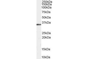 ABIN2560227 staining (0. (STUB1 antibody  (C-Term))