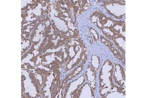 IHC analysis of WDR44 using anti-WDR44 antibody (ABIN7600394). (WDR44 antibody  (AA 188-913))