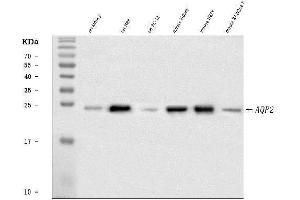 Western blot analysis of Aquaporin 2 using anti-Aquaporin 2 antibody (ABIN3043788). (AQP2 antibody  (C-Term))