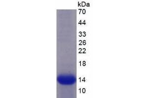 Image no. 1 for Sema Domain, Seven Thrombospondin Repeats (Type 1 and Type 1-Like), Transmembrane Domain (TM) and Short Cytoplasmic Domain, (Semaphorin) 5B (SEMA5B) (AA 36-161) protein (His tag) (ABIN1099449) (SEMA5B Protein (AA 36-161) (His tag))