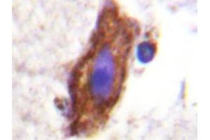 Immunohistochemistry analyzes of AP20219PU-N CSFR antibody in paraffin-embedded human brain tissue. (CSF1R antibody)