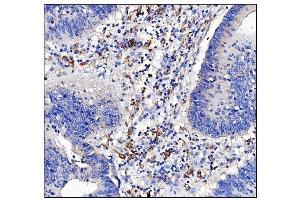 IHC analysis of CD16 using anti-CD16 antibody (ABIN5693196).