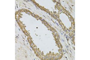 Immunohistochemistry of paraffin-embedded human prostate using PIK3CA antibody. (PIK3CA antibody)