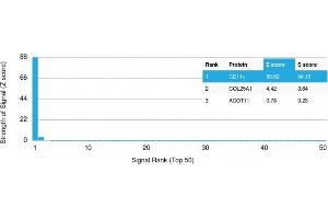 Analysis of Protein Array containing >19,000 full-length human proteins using CD11c Mouse Monoclonal Antibody (ITGAX/2507) Z- and S- Score: The Z-score represents the strength of a signal that a monoclonal antibody (Monoclonal Antibody) (in combination with a fluorescently-tagged anti-IgG secondary antibody) produces when binding to a particular protein on the HuProtTM array. (CD11c antibody  (AA 637-827))