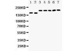 Anti-DCC antibody, Western blotting Lane 1: Rat Brain Tissue Lysate Lane 2: Mouse Brain Tissue Lysate Lane 3: U87 Cell Lysate Lane 4: SW620 Cell Lysate Lane 5: COLO320 Cell Lysate Lane 6: 293T Cell Lysate Lane 7: HELA Cell Lysate (DCC antibody  (N-Term))