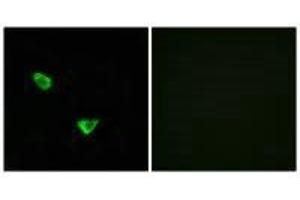 Immunofluorescence analysis of MCF-7 cells, using CHSS2 antibody. (CHPF antibody)