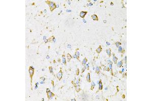 Immunohistochemistry of paraffin-embedded Mouse brain using ADIPOQ antibody (ABIN3016228, ABIN3016229, ABIN3016230 and ABIN6219638) at dilution of 1:100 (40x lens). (ADIPOQ antibody  (AA 19-104))