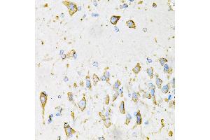 Immunohistochemistry of paraffin-embedded Mouse brain using ADIPOQ antibody (ABIN3016228, ABIN3016229, ABIN3016230 and ABIN6219638) at dilution of 1:100 (40x lens). (ADIPOQ antibody  (AA 19-104))