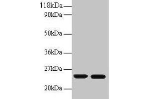 Western blot All lanes: RBP4 antibody at 2 μg/mL Lane 1: Human positive serum at 1: 10 Lane 2: Human positive serum at 1: 100 Secondary Goat polyclonal to rabbit IgG at 1/50000 dilution Predicted band size: 24 kDa Observed band size: 24 kDa (RBP4 antibody  (AA 19-201))