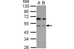 Western Blotting (WB) image for anti-TAP Binding Protein-Like (TAPBPL) (AA 140-399) antibody (ABIN1501298) (TAPBPL antibody  (AA 140-399))