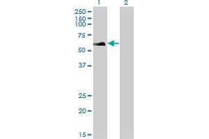 Western Blot analysis of RAD18 expression in transfected 293T cell line by RAD18 monoclonal antibody (M01), clone 3H7. (RAD18 antibody  (AA 332-430))
